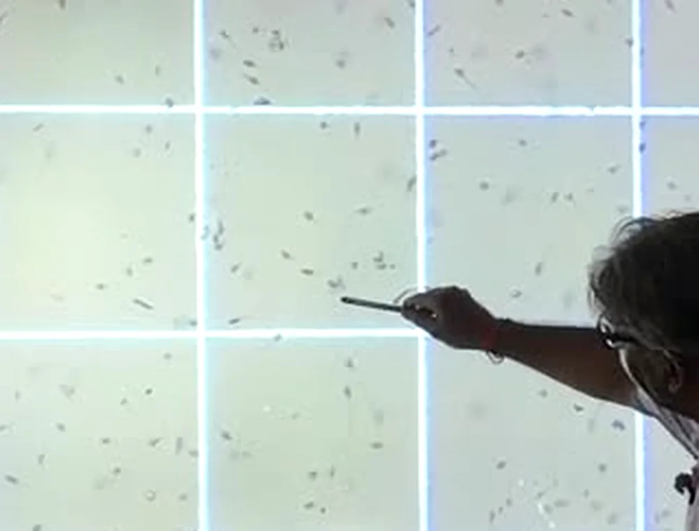 A sperm counting chamber field projected during andrology training in Delhi